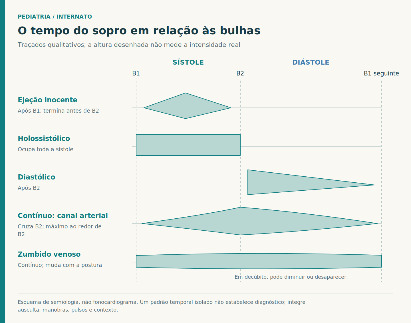 Cinco traçados conceituais alinhados às mesmas marcas B1, B2 e B1 seguinte: ejeção inocente, holossistólico, diastólico, contínuo do canal arterial e zumbido venoso.