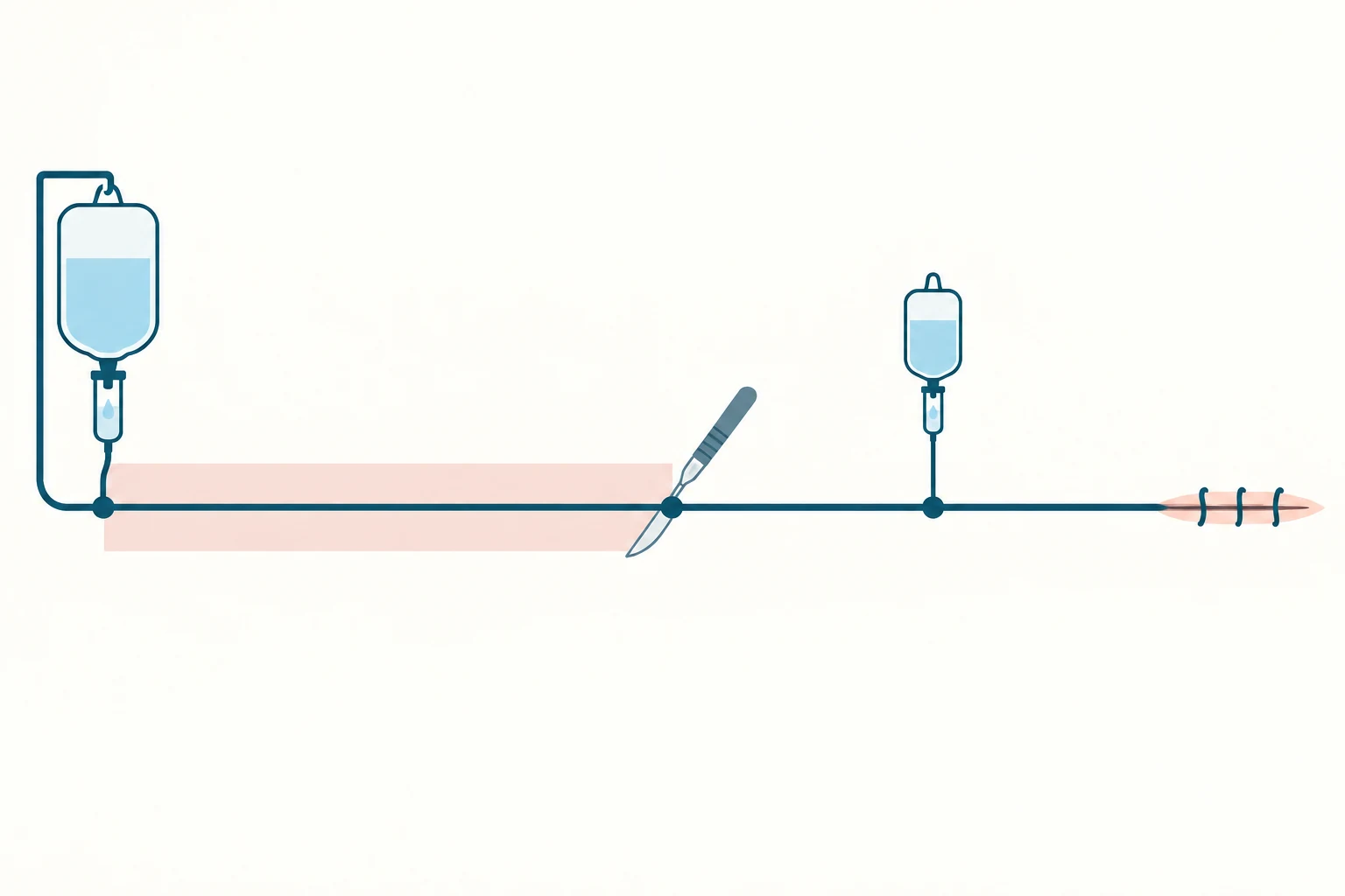 Linha do tempo horizontal: bolsa de soro com o antibiótico à esquerda, faixa clara até o bisturi que marca a incisão, gota de repique no meio do trajeto e sutura fechada no fim, onde a linha termina.