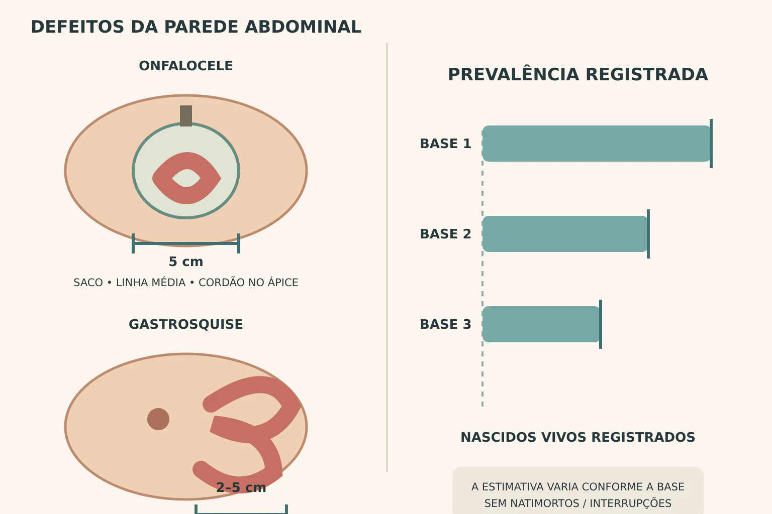 Prancha em duas metades. À esquerda, dois cortes da parede abdominal de recém-nascido com compasso medindo o defeito. À direita, três barras de prevalência com compassos e uma linha tracejada marcando o denominador comum.