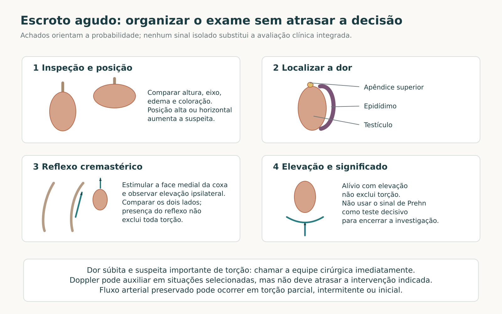 Quatro quadros esquemáticos do exame do escroto agudo: posição, localização da dor, reflexo cremastérico e significado da elevação.