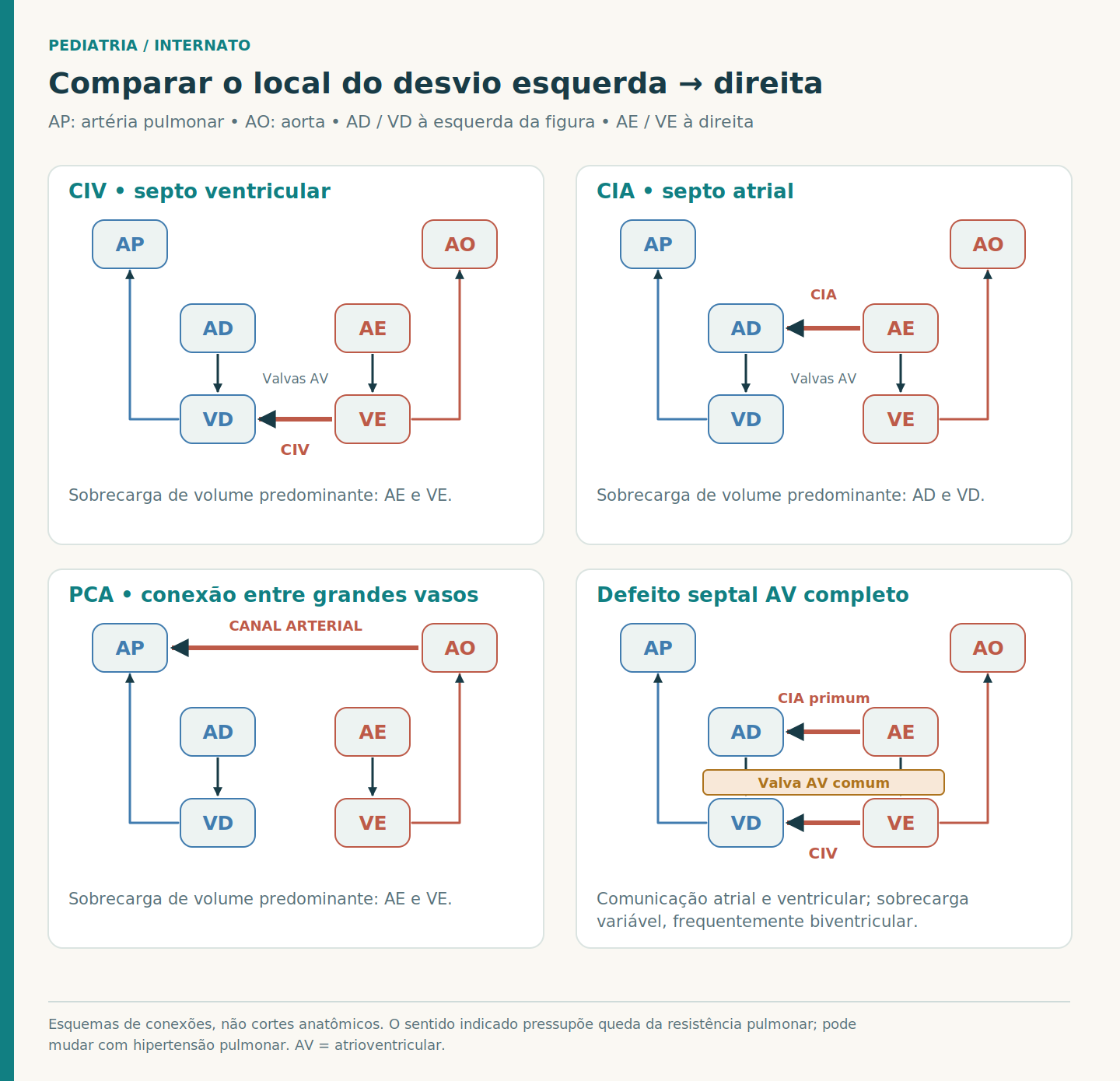 Quatro esquemas com orientação idêntica comparam CIV, CIA, persistência do canal arterial e defeito septal atrioventricular completo; setas mostram o local do desvio, e legendas indicam as câmaras sobrecarregadas.