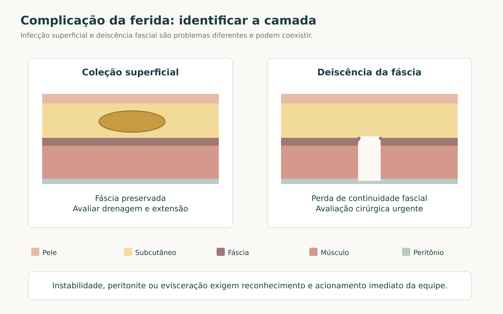 Dois cortes da ferida operatória comparam coleção superficial com fáscia íntegra e separação da camada fascial.