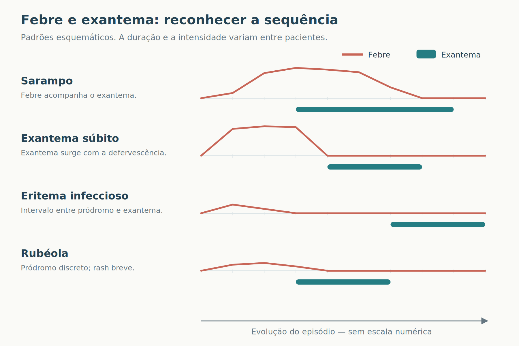 Quatro linhas temporais esquemáticas identificadas: febre e exantema sobrepostos no sarampo; exantema após defervescência no exantema súbito; intervalo após pródromo no eritema infeccioso; quadro discreto e rash breve na rubéola.