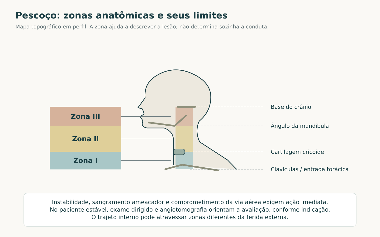 Perfil do pescoço com zona I entre clavículas e cricoide, zona II até o ângulo da mandíbula e zona III até a base do crânio.